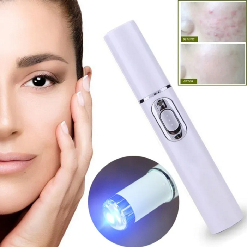 Pluma Laser Para Acné